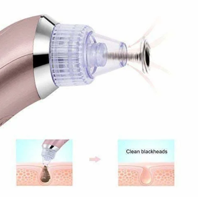 Rechargeable Blackhead & Whitehead Remover: Say goodbye to stubborn blackheads and hello to clear, radiant skin — all from the comfort of your home.